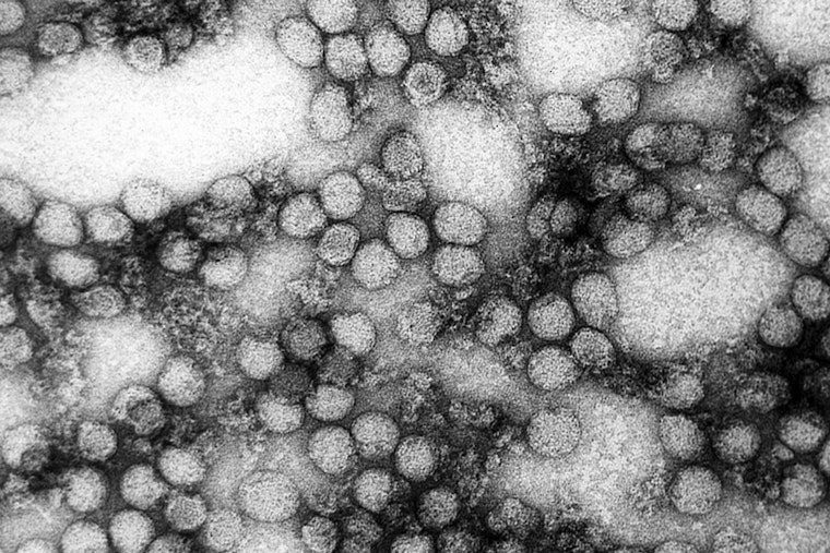 Rare Killer Tick Virus Stalks Brainerd Lakes Cabins