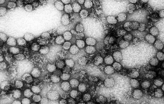 Rare Killer Tick Virus Stalks Brainerd Lakes Cabins
