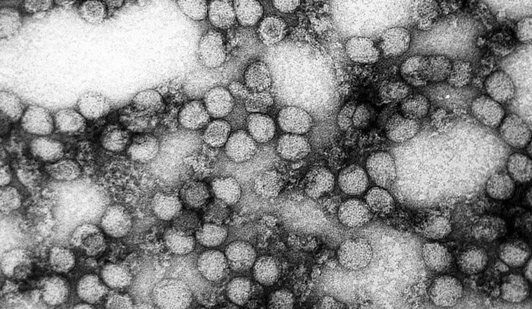 Rare Killer Tick Virus Stalks Brainerd Lakes Cabins