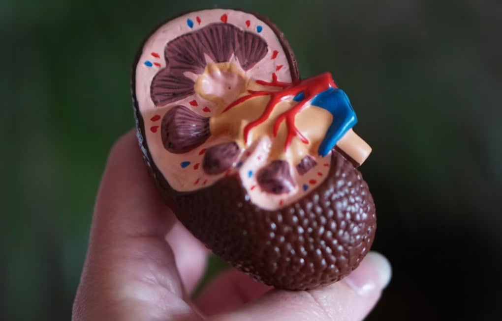 Seaport Startup Snags $1.9 Billion Kidney Deal With Lilly