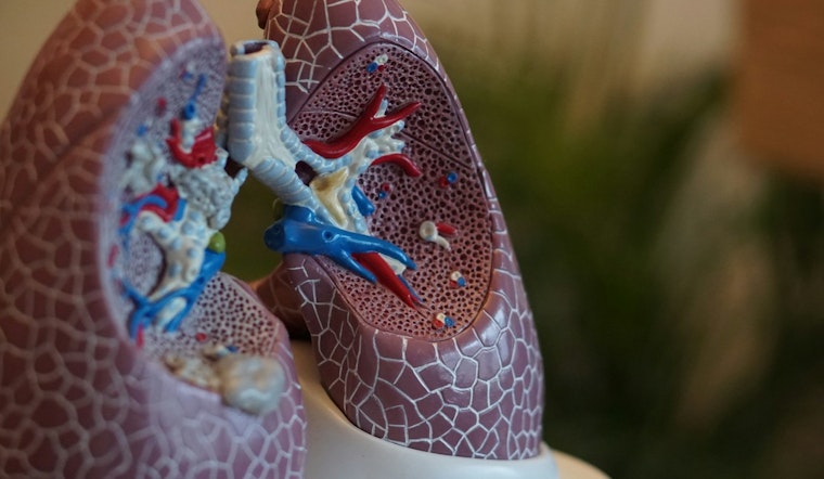 UCLA Lung Cancer Trial Sees New Drug Crush Recurrence Risk