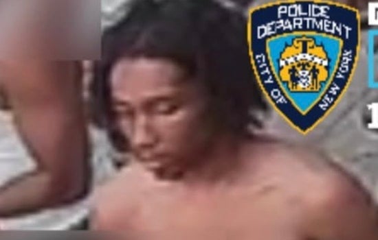 Bronx Chain-Snatch Ambush: Man Shot In Face During Morris Heights Robbery Attempt