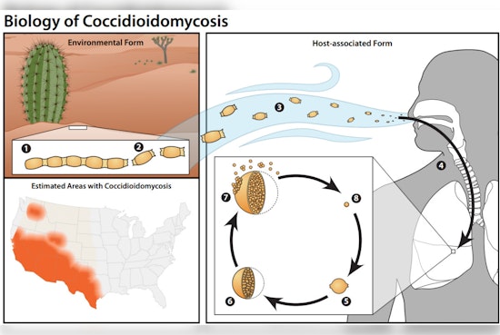Dust Devil Danger as CDC Sounds Valley Fever Alarm For Phoenix