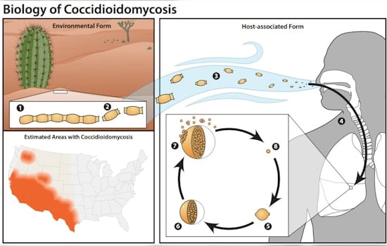 Dust Devil Danger as CDC Sounds Valley Fever Alarm For Phoenix