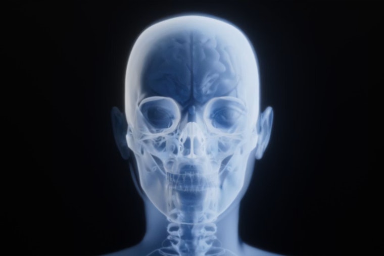 Deepfake X-Rays Put Columbus Hospitals On High Alert
