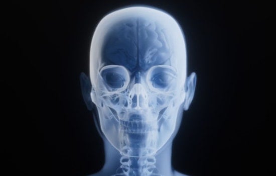 Deepfake X-Rays Put Columbus Hospitals On High Alert