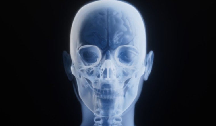 Deepfake X-Rays Put Columbus Hospitals On High Alert