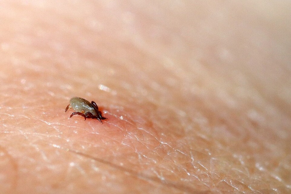 Detroit Docs Sound Alarm On Tick-Bite Allergy That Can Steal Your Steak