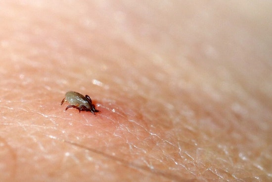 Detroit Docs Sound Alarm On Tick-Bite Allergy That Can Steal Your Steak