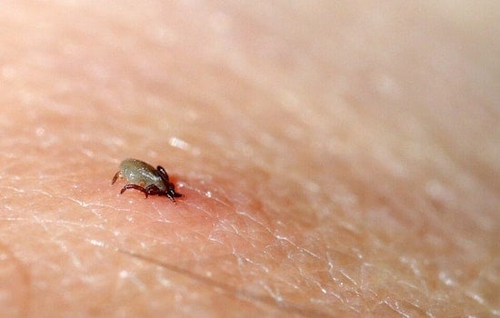Detroit Docs Sound Alarm On Tick-Bite Allergy That Can Steal Your Steak