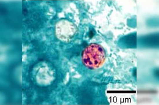 Diarrhea Parasite Invades Georgia As Summer Surge Spooks Health Officials