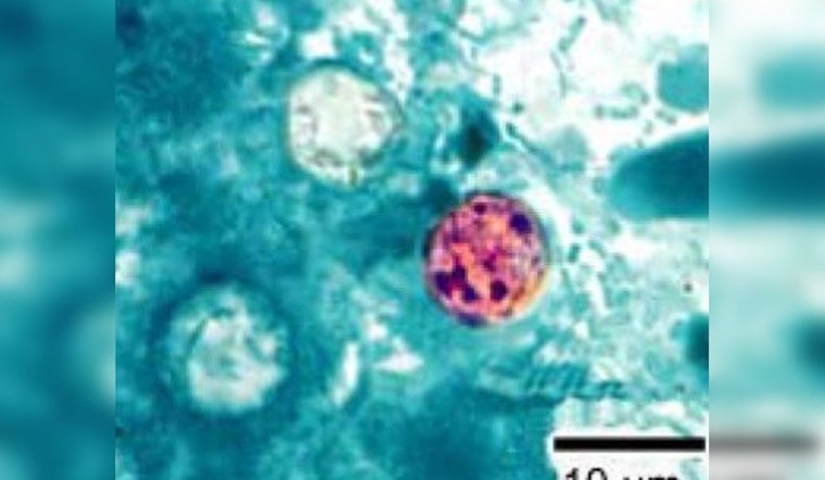 Diarrhea Parasite Invades Georgia As Summer Surge Spooks Health Officials