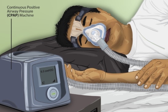 Docs Warn Ignored Sleep Apnea Speeds Seniors' Cognitive Decline by 69 Percent