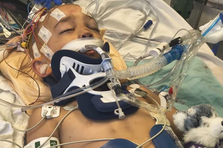 Driftwood Horror On Bellingham Beach Leaves 6-Year-Old Fighting For Life