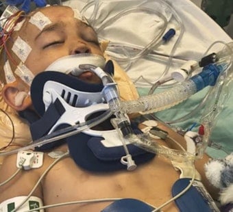 Driftwood Horror On Bellingham Beach Leaves 6-Year-Old Fighting For Life