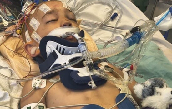 Driftwood Horror On Bellingham Beach Leaves 6-Year-Old Fighting For Life