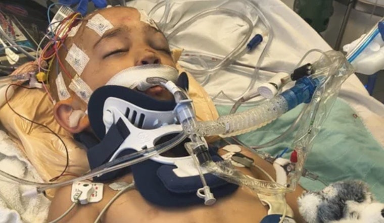 Driftwood Horror On Bellingham Beach Leaves 6-Year-Old Fighting For Life