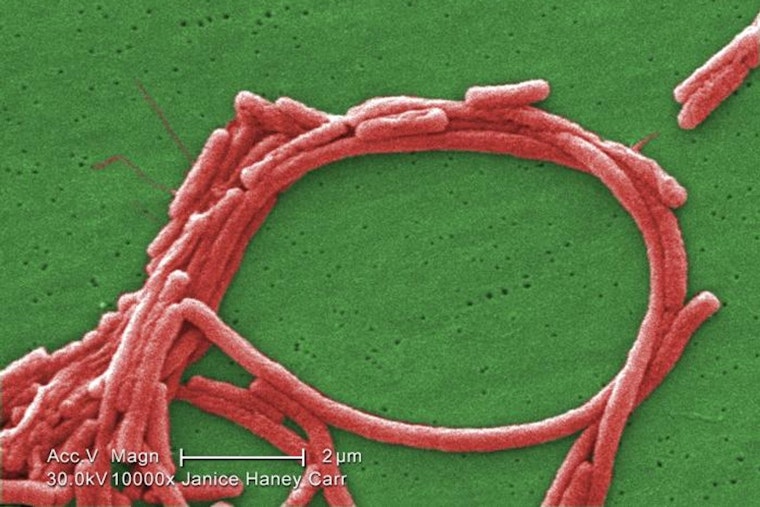 Frankfort Legionnaires’ Cases Spark Probe As Officials Say Public Risk Is Low