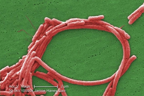 Frankfort Legionnaires’ Cases Spark Probe As Officials Say Public Risk Is Low