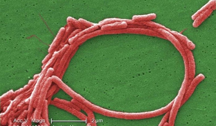 Frankfort Legionnaires’ Cases Spark Probe As Officials Say Public Risk Is Low