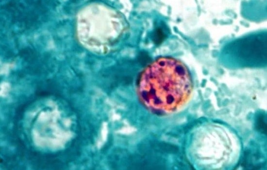Galveston Cyclospora Scare as 14 Cases Confirmed, More Probed