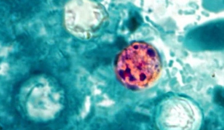 Galveston Cyclospora Scare as 14 Cases Confirmed, More Probed
