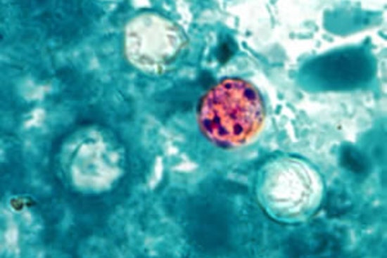 Knox County Confirms Two Cases Of ‘Explosive Diarrhea’ Parasite