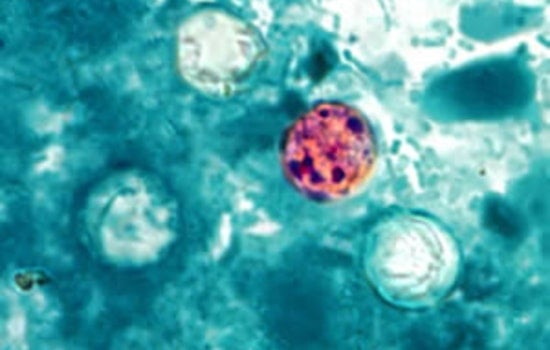 Knox County Confirms Two Cases Of ‘Explosive Diarrhea’ Parasite