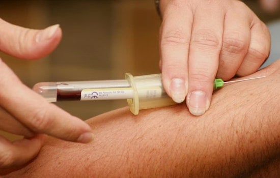 La Jolla Labs Take Aim at Cholesterol in Double Hit on Heart Disease and Cancer