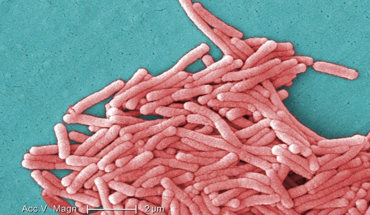 Legionnaires Scare Shakes Upper East Side Near Lenox Hill