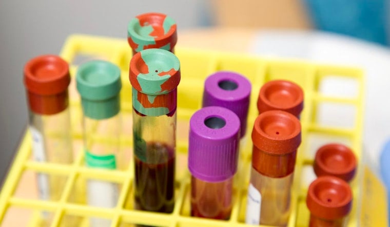 Milwaukee Scientists Eye Game-Changing Alzheimer’s Blood Test
