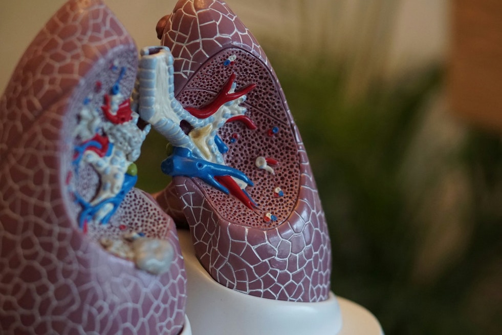 Only Six Louisiana Parishes Below U.S. Lung Cancer Rate