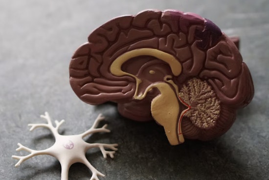 San Antonio Sleep Study Flags Long Nights As Possible Alzheimer Clue