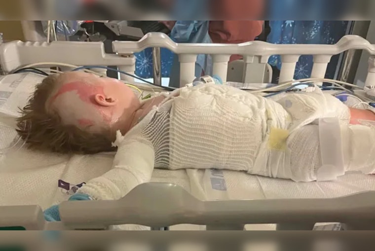 Somerset Toddler Badly Burned After Crockpot Horror In Family Kitchen