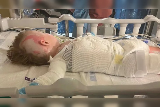 Somerset Toddler Badly Burned After Crockpot Horror In Family Kitchen