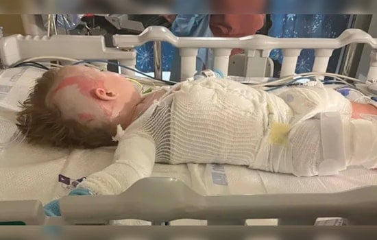 Somerset Toddler Badly Burned After Crockpot Horror In Family Kitchen