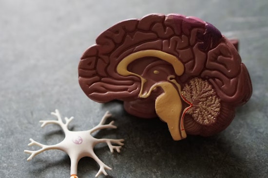 UCSF Brain Trust Bets On Two-Drug Salvo In High-Stakes San Francisco Alzheimer’s Trial