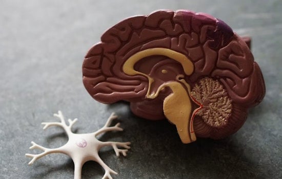 UCSF Brain Trust Bets On Two-Drug Salvo In High-Stakes San Francisco Alzheimer’s Trial