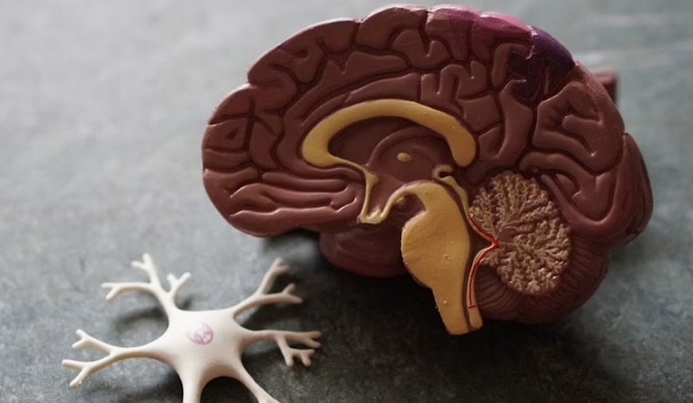 UCSF Brain Trust Bets On Two-Drug Salvo In High-Stakes San Francisco Alzheimer’s Trial