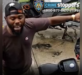 Brooklyn Senior’s Cheek Bitten in Wild Midday Rockaway Parkway Beatdown