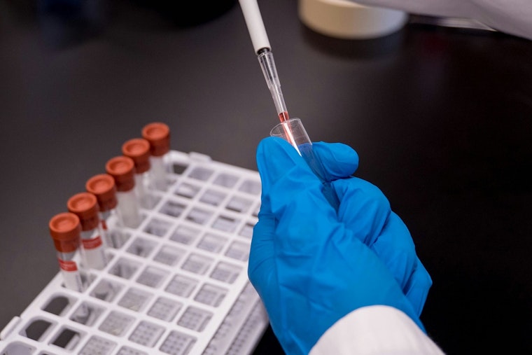 Cambridge Eye Cancer Biotech Aura Cuts 20% of Staff to Fund Late-Stage Trial