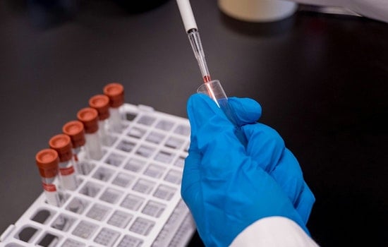Cambridge Eye Cancer Biotech Aura Cuts 20% of Staff to Fund Late-Stage Trial