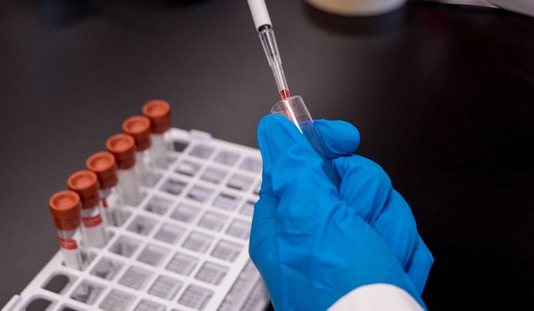 Cambridge Eye Cancer Biotech Aura Cuts 20% of Staff to Fund Late-Stage Trial