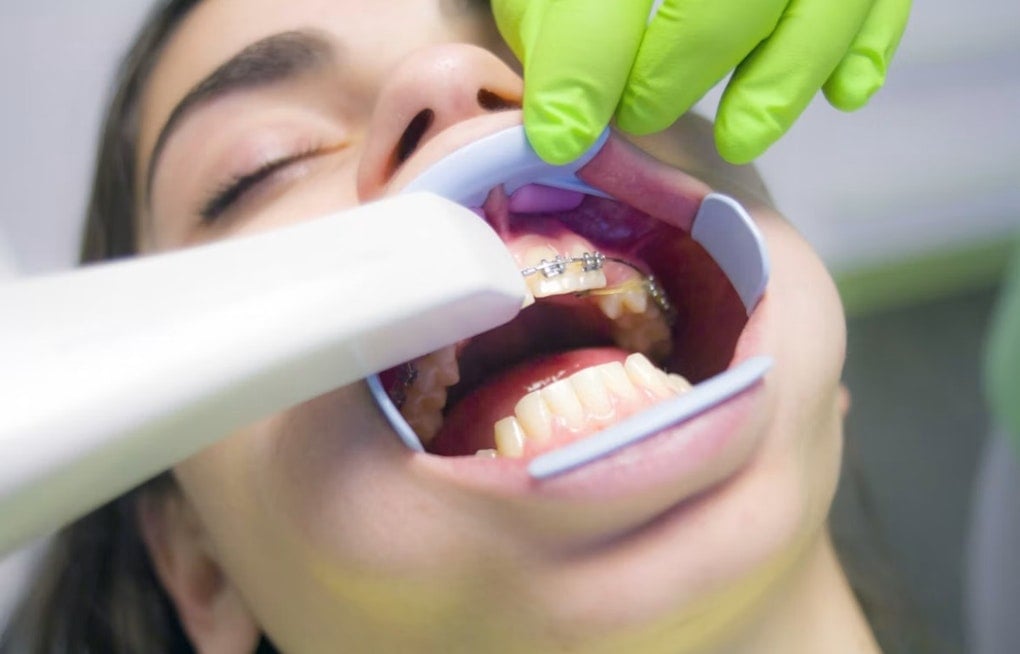 Detroit Kids Have Free Dental Care, But Covenant Says More Than Half Skip It