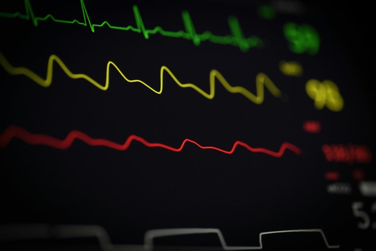 Ferguson Dad Turns Son's Cardiac Death Into Free Heart Screenings for Teens