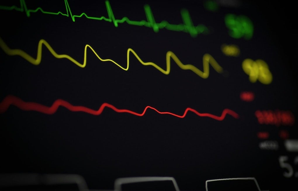 Ferguson Dad Turns Son's Cardiac Death Into Free Heart Screenings for Teens