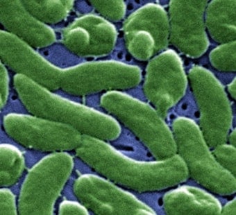 Florida's Third Flesh-Eating Bacteria Death of 2026 Confirmed in Bay County