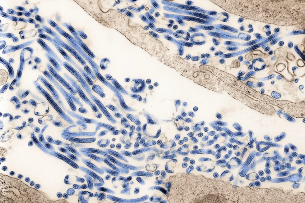Legionnaires’ Scare at Thornville Nursing Home Spurs Water Probe