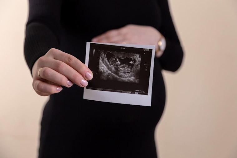 Louisville's New Fetal Care Center Aims to Keep Kentucky's Riskiest Pregnancies Home