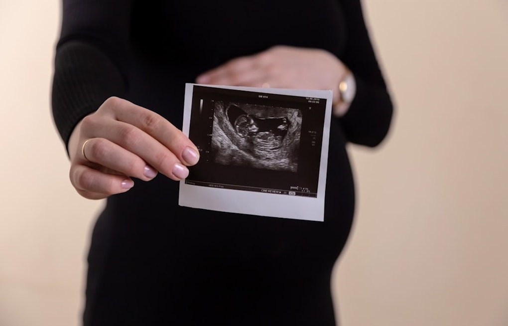 Louisville's New Fetal Care Center Aims to Keep Kentucky's Riskiest Pregnancies Home